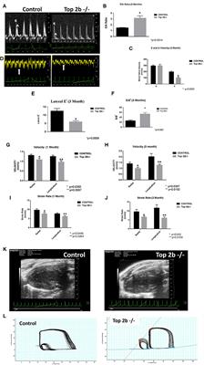 Topoisomerase 2B Decrease Results in Diastolic Dysfunction via p53 and Akt: A Novel Pathway